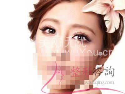 <a href=http://www.f3bb6.cn/listinfo-724-0.html target=_blank class=infotextkey>雙眼皮</a>,<a href=http://www.f3bb6.cn/listinfo-724-0.html target=_blank class=infotextkey>雙眼皮</a>整形手術(shù)