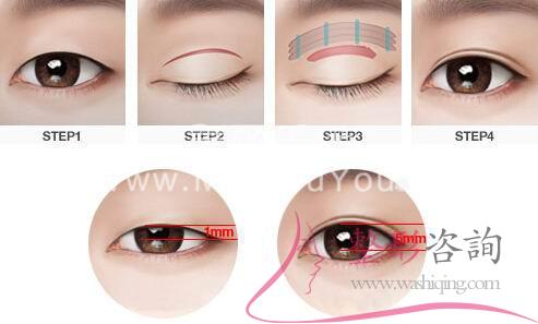 <a href=http://www.f3bb6.cn/listinfo-724-0.html target=_blank class=infotextkey>雙眼皮</a>術前設計方案：哪些形狀<a href=http://www.f3bb6.cn/listinfo-724-0.html target=_blank class=infotextkey>雙眼皮</a>好看