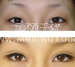 <a href=http://www.f3bb6.cn/listinfo-724-0.html target=_blank class=infotextkey>雙眼皮</a>商品的原理是什么?