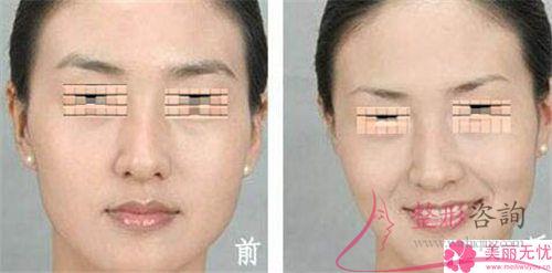 一次皮秒激光<a href=http://www.f3bb6.cn/listinfo-658-0.html target=_blank class=infotextkey>洗眉</a>能夠清潔凈紋眉嗎