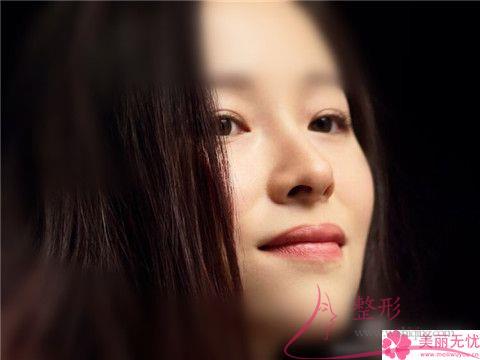 最好預備幾千塊就可實施抬高鼻梁