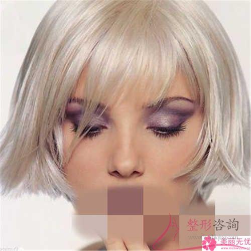 移植額部頭發后作用會持久展現嗎？要怎么樣付費？