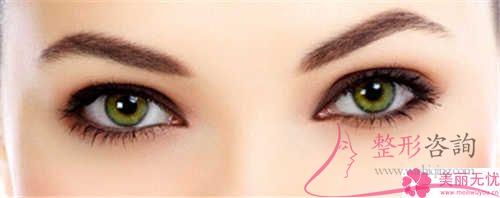 重瞼太寬該怎樣治療
