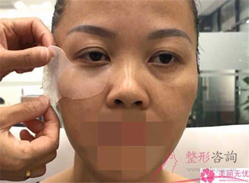 非手術<a href=http://www.f3bb6.cn/listinfo-614-0.html target=_blank class=infotextkey>除皺</a>和手術<a href=http://www.f3bb6.cn/listinfo-614-0.html target=_blank class=infotextkey>除皺</a>有著哪一種效用