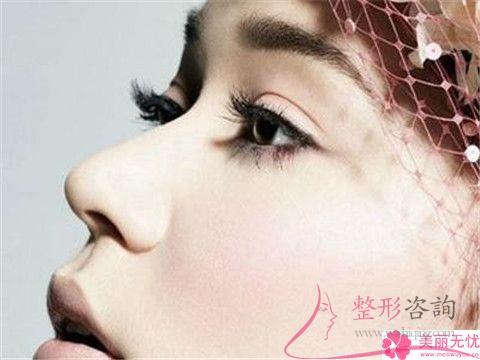 <a href=http://www.f3bb6.cn/listinfo-754-0.html target=_blank class=infotextkey>鼻翼</a>縮小手術之后會否遺留下傷疤