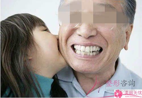 種植牙的種植體常規的種植牙材料都有幾個?價錢要多少