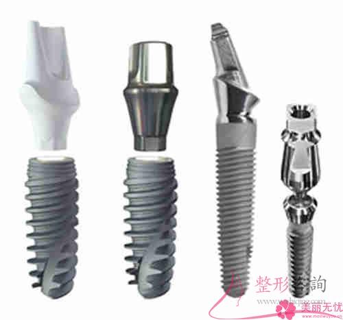 種植牙的種植體常規的種植牙材料都有幾個?價錢要多少