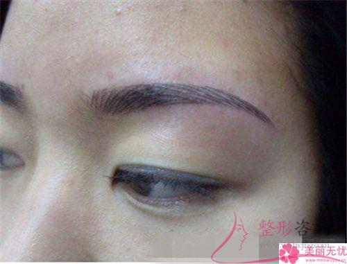 線條感明顯的眉毛可能的費用是多少？漂亮嗎