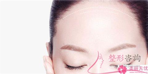 <a href=http://www.f3bb6.cn/listinfo-731-0.html target=_blank class=infotextkey>玻尿酸</a><a href=http://www.f3bb6.cn/listinfo-643-0.html target=_blank class=infotextkey>豐額頭</a>手術(shù)后康復(fù)的時間大概是5-7天嗎