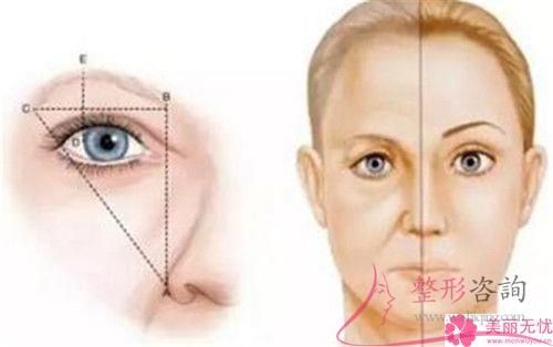 可以采用聚乙烯、聚四氟乙烯人工合成代品<a href=http://www.f3bb6.cn/listinfo-654-0.html target=_blank class=infotextkey>隆眉弓</a>嗎