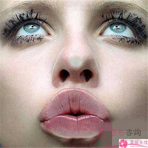 唇外翻幾歲矯正合適