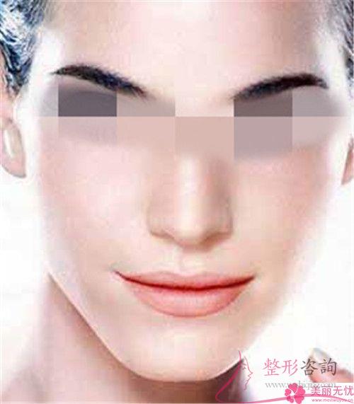 <a href=http://www.f3bb6.cn/listinfo-612-0.html target=_blank class=infotextkey>面部提升</a>適合哪些人群