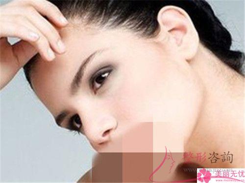 額頭上發(fā)際線交匯處有疤痕可以通過紋發(fā)際線來遮住嗎