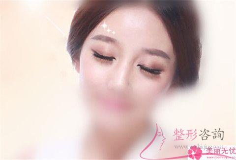 額頭上發(fā)際線交匯處有疤痕可以通過紋發(fā)際線來遮住嗎