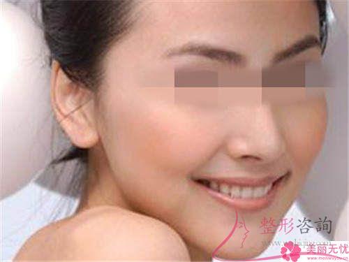 <a href=http://www.f3bb6.cn/listinfo-629-0.html target=_blank class=infotextkey>下頜角</a>整形做完會不會臉部皮膚松垂
