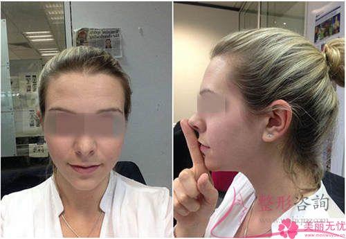 您們真正的明白下<a href=http://www.f3bb6.cn/listinfo-644-0.html target=_blank class=infotextkey>頜骨整形</a>美容嗎