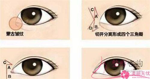 成都實(shí)施無(wú)痕<a href=http://www.f3bb6.cn/listinfo-711-0.html target=_blank class=infotextkey>開眼角</a>術(shù)花多少錢？貴么