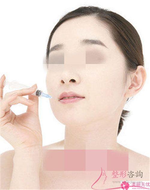 脂肪和透明質酸是不是均可以被作為去除法令紋的醫用材料