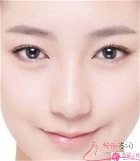 <a href=http://www.f3bb6.cn/listinfo-754-0.html target=_blank class=infotextkey>鼻翼</a>美容整形術(shù)方式都有哪幾種