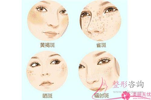 <a href=http://www.f3bb6.cn/listinfo-768-0.html target=_blank class=infotextkey>微針</a>去斑安全性高嗎