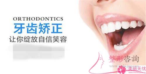 最科學的<a href=http://www.f3bb6.cn/listinfo-824-0.html target=_blank class=infotextkey>牙齒矯正</a>類型具體有哪些