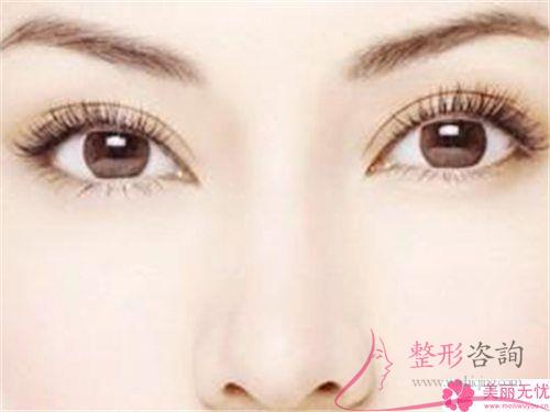 無痕翹睫法<a href=http://www.f3bb6.cn/listinfo-724-0.html target=_blank class=infotextkey>雙眼皮</a>多久能恢復自然
