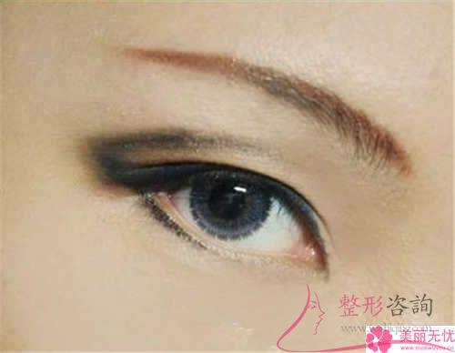 無痕翹睫法<a href=http://www.f3bb6.cn/listinfo-724-0.html target=_blank class=infotextkey>雙眼皮</a>多久能恢復自然