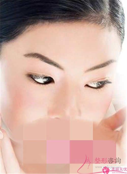 超聲法<a href=http://www.f3bb6.cn/listinfo-708-0.html target=_blank class=infotextkey>去眼袋</a>多久可以恢復(fù)好