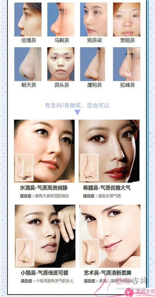 假體<a href=http://www.f3bb6.cn/listinfo-737-0.html target=_blank class=infotextkey>隆鼻</a>效果若何顯現呢