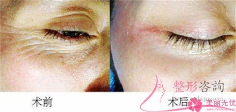 只做一次<a href=http://www.f3bb6.cn/listinfo-610-0.html target=_blank class=infotextkey>熱瑪吉</a>怎么收費?間隙多久二次?