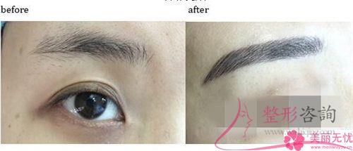 <a href=http://www.f3bb6.cn/listinfo-658-0.html target=_blank class=infotextkey>洗眉</a>毛用激光能清潔凈嗎？費用是呢