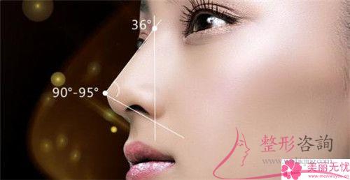 短鼻延長術合適哪種人做