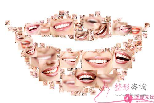 它也是種植牙，為何花費(fèi)不同