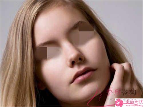 硅膠假體<a href=http://www.f3bb6.cn/listinfo-737-0.html target=_blank class=infotextkey>隆鼻</a>以后應該如何防治病毒感染