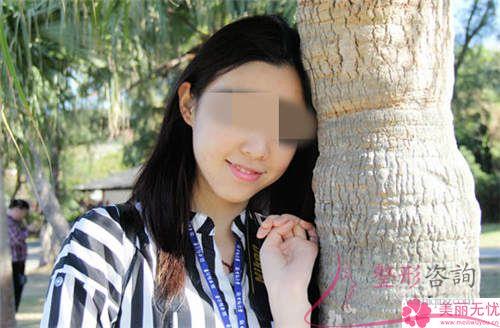 <a href=http://www.f3bb6.cn/listinfo-629-0.html target=_blank class=infotextkey>下頜角</a>整形手術(shù)哪一個(gè)項(xiàng)目美容效果好