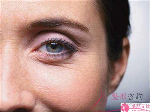 冰電波<a href=http://www.f3bb6.cn/listinfo-614-0.html target=_blank class=infotextkey>除皺</a>手術除去能祛皺紋另有什么療效？