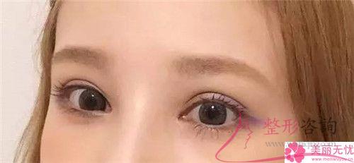 根狀眉與霧狀眉應怎么樣尋到