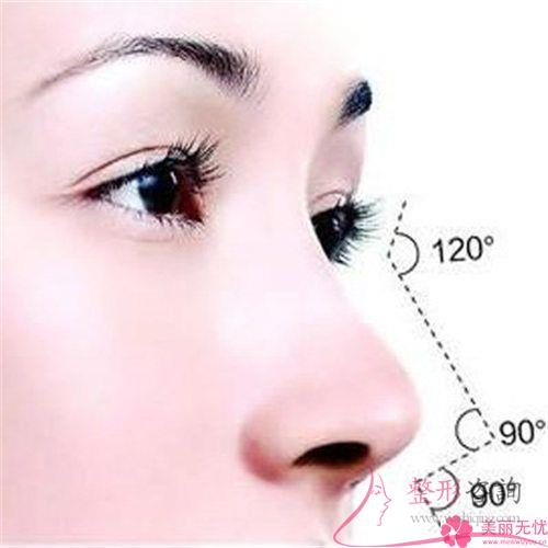 短鼻延長術美化效果如何