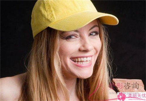 <a href=http://www.f3bb6.cn/listinfo-733-0.html target=_blank class=infotextkey>肉毒素</a>注射瘦大小腿改善效果咋樣