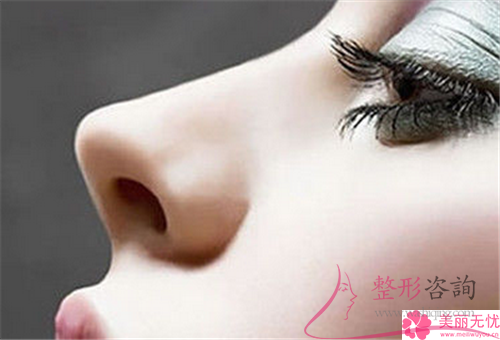 <a href=http://www.f3bb6.cn/listinfo-737-0.html target=_blank class=infotextkey>隆鼻</a>手術(shù)后完全恢復(fù)需要花多久的時(shí)間