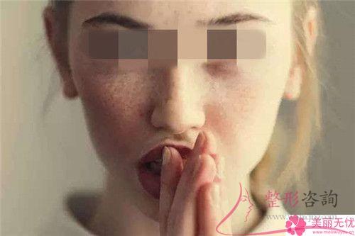 醫美<a href=http://www.f3bb6.cn/listinfo-795-0.html target=_blank class=infotextkey>祛斑</a>期間如果臉上特別紅正常嗎