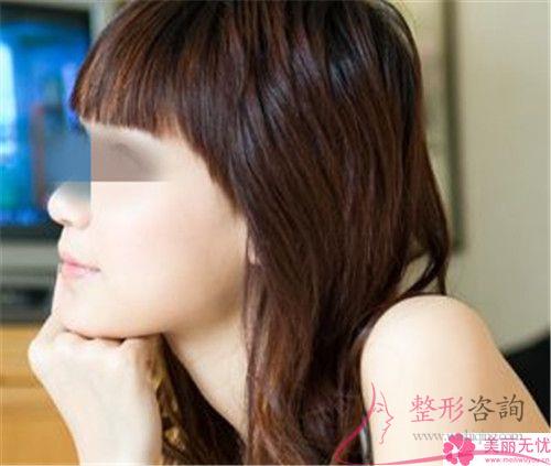 溫州<a href=http://www.f3bb6.cn/listinfo-731-0.html target=_blank class=infotextkey>玻尿酸</a>面部填充<a href=http://www.f3bb6.cn/listinfo-614-0.html target=_blank class=infotextkey>除皺</a>術手術費用貴嗎