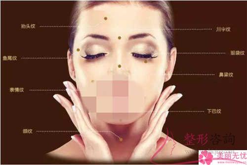 冰電波<a href=http://www.f3bb6.cn/listinfo-614-0.html target=_blank class=infotextkey>除皺</a>整形手術有哪3種特點？治療一次好多元？