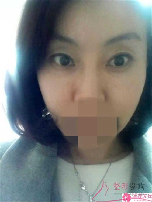 利用干細胞<a href=http://www.f3bb6.cn/listinfo-614-0.html target=_blank class=infotextkey>除皺</a>抗衰能起作用嗎