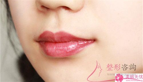 實施重唇修復手術有何手術風險嗎