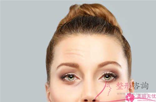 平常的<a href=http://www.f3bb6.cn/listinfo-614-0.html target=_blank class=infotextkey>除皺</a>成效,POP蛋白鋸齒線埋線懸吊<a href=http://www.f3bb6.cn/listinfo-614-0.html target=_blank class=infotextkey>除皺</a>是不是可以達到