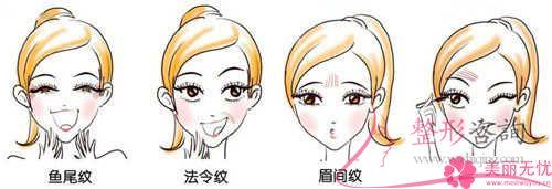 平常的<a href=http://www.f3bb6.cn/listinfo-614-0.html target=_blank class=infotextkey>除皺</a>抗衰成效,鋸齒線懸掛去皺方式能不能達到