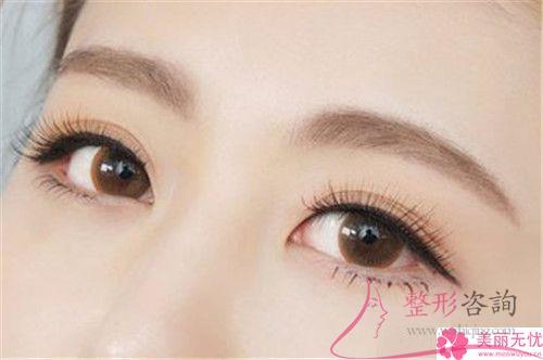 激光祛咖啡斑手術前提因素有哪一些?