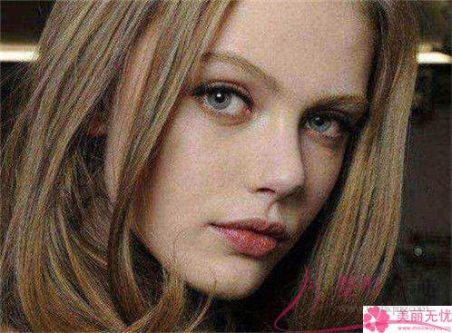 維e清理斑點健康嗎