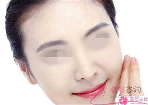 膨體聚四氟乙烯<a href=http://www.f3bb6.cn/listinfo-737-0.html target=_blank class=infotextkey>隆鼻</a>復原時間得要好久？適宜哪些人群？